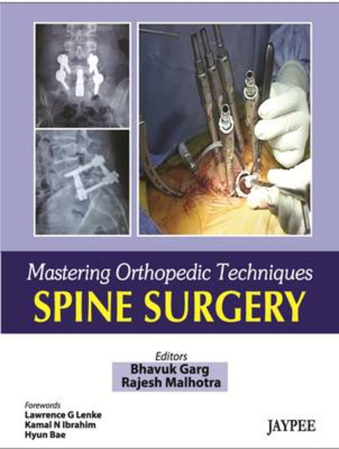 Cover image for Mastering Orthopaedic Techniques Spine Surgery ISBN 9788184488968