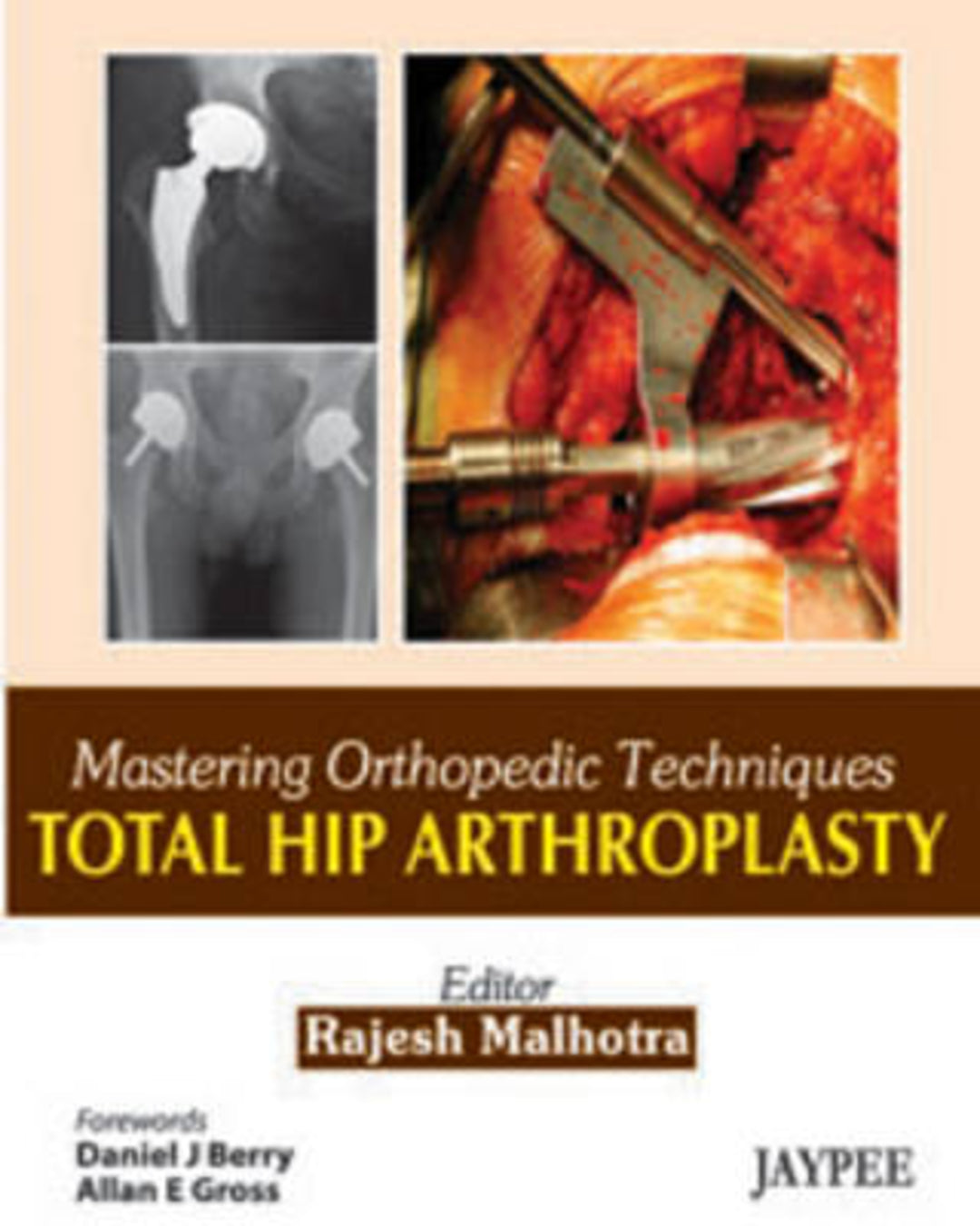 Cover image for Mastering Orthopedic Techniques: Total Hip Arthroplasty ISBN 9788184488982