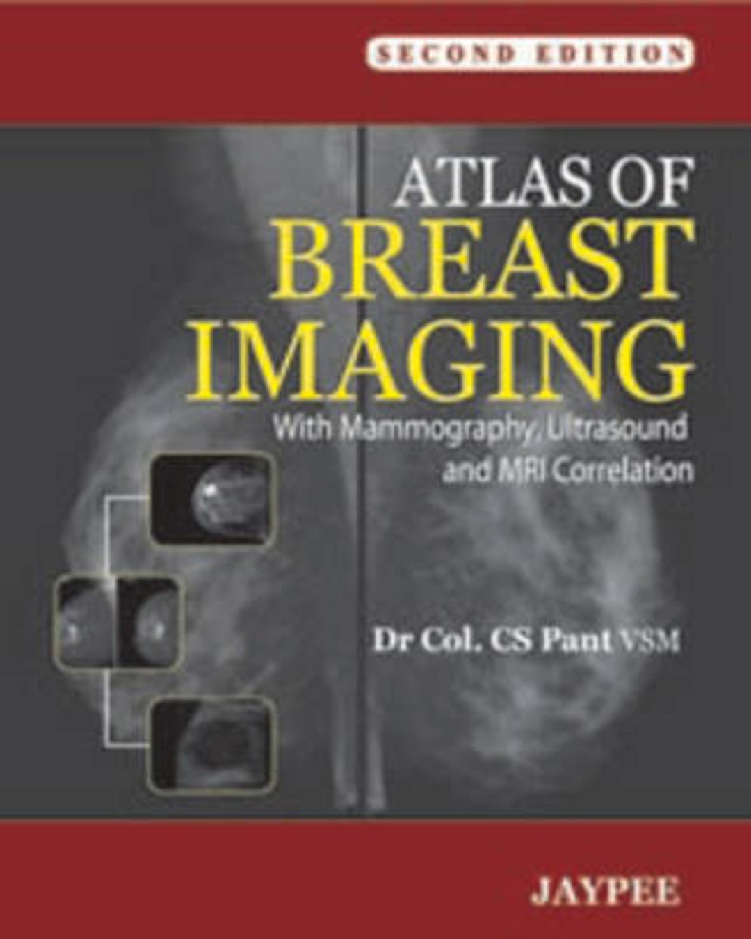 Cover image for Atlas of Breast Imaging ISBN 9789350251874