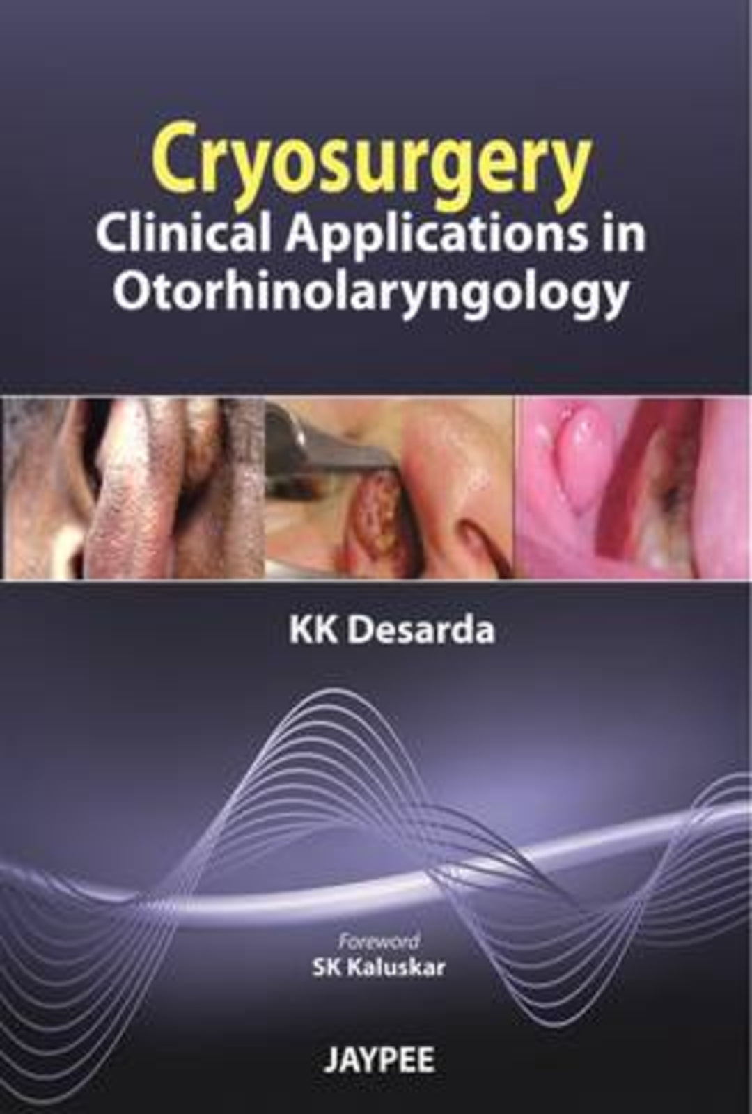 Cover image for Cryosurgery ISBN 9789350252086