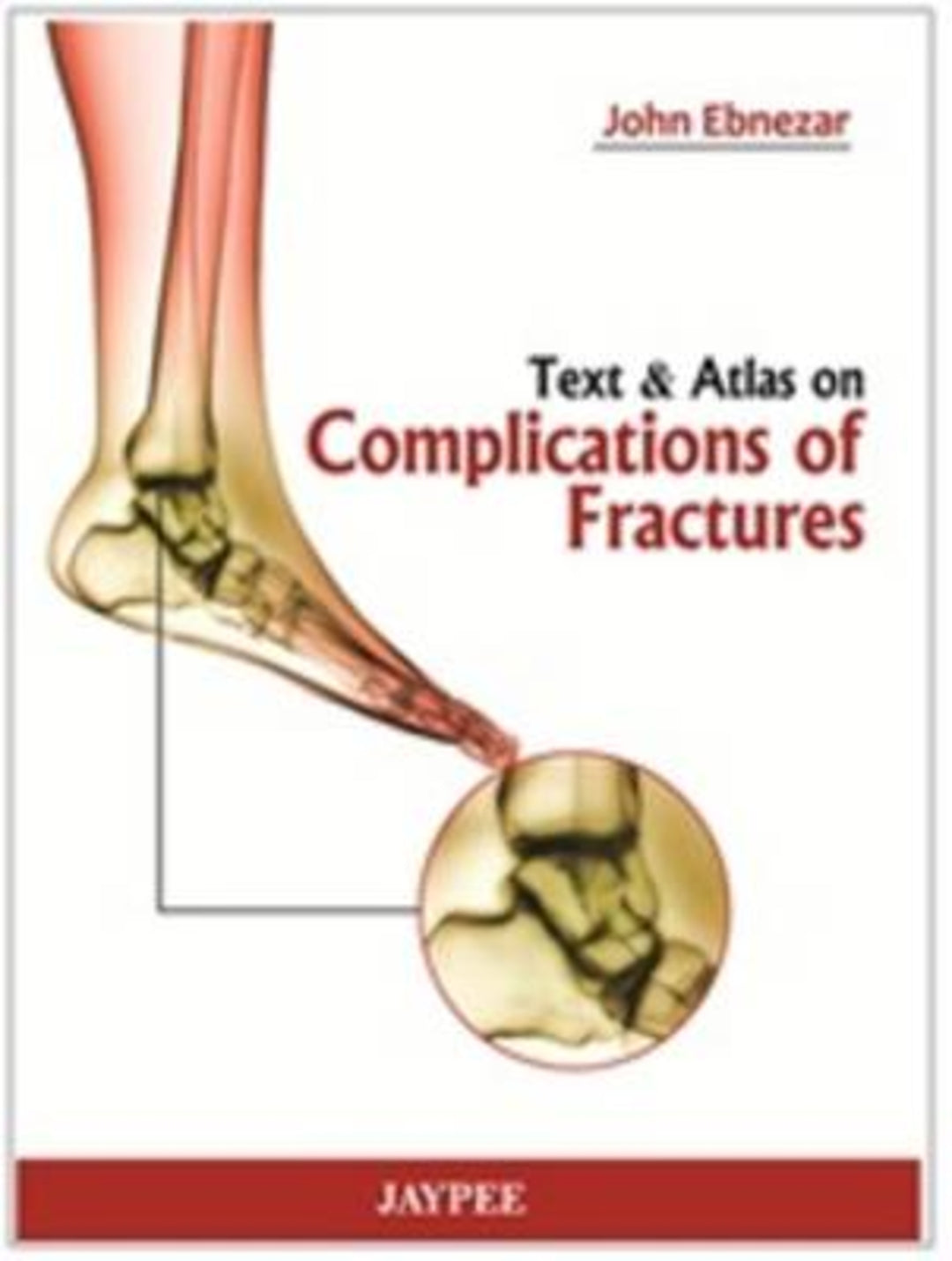 Cover image for Text and Atlas of Complications of Fractures ISBN 9789350254929
