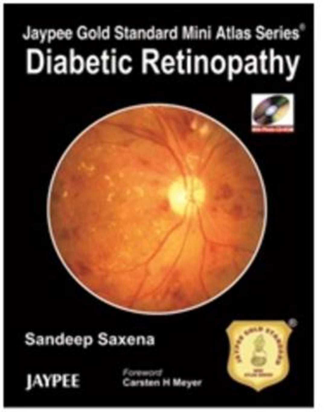 Cover image for Jaypee Gold Standard Mini Atlas Series: Diabetic Retinopathy ISBN 9789350255810