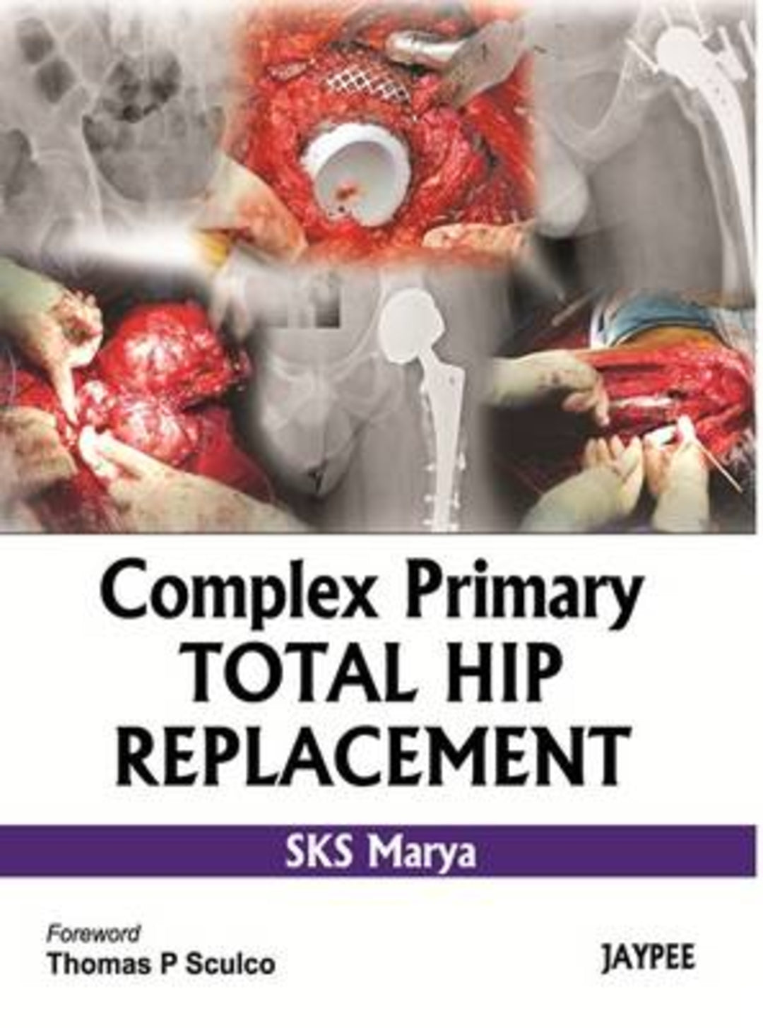 Cover image for Complex Primary Total Hip Replacement ISBN 9789350255841