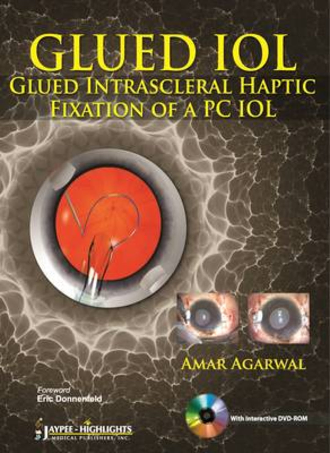 Cover image for GLUED IOL ISBN 9789350259962