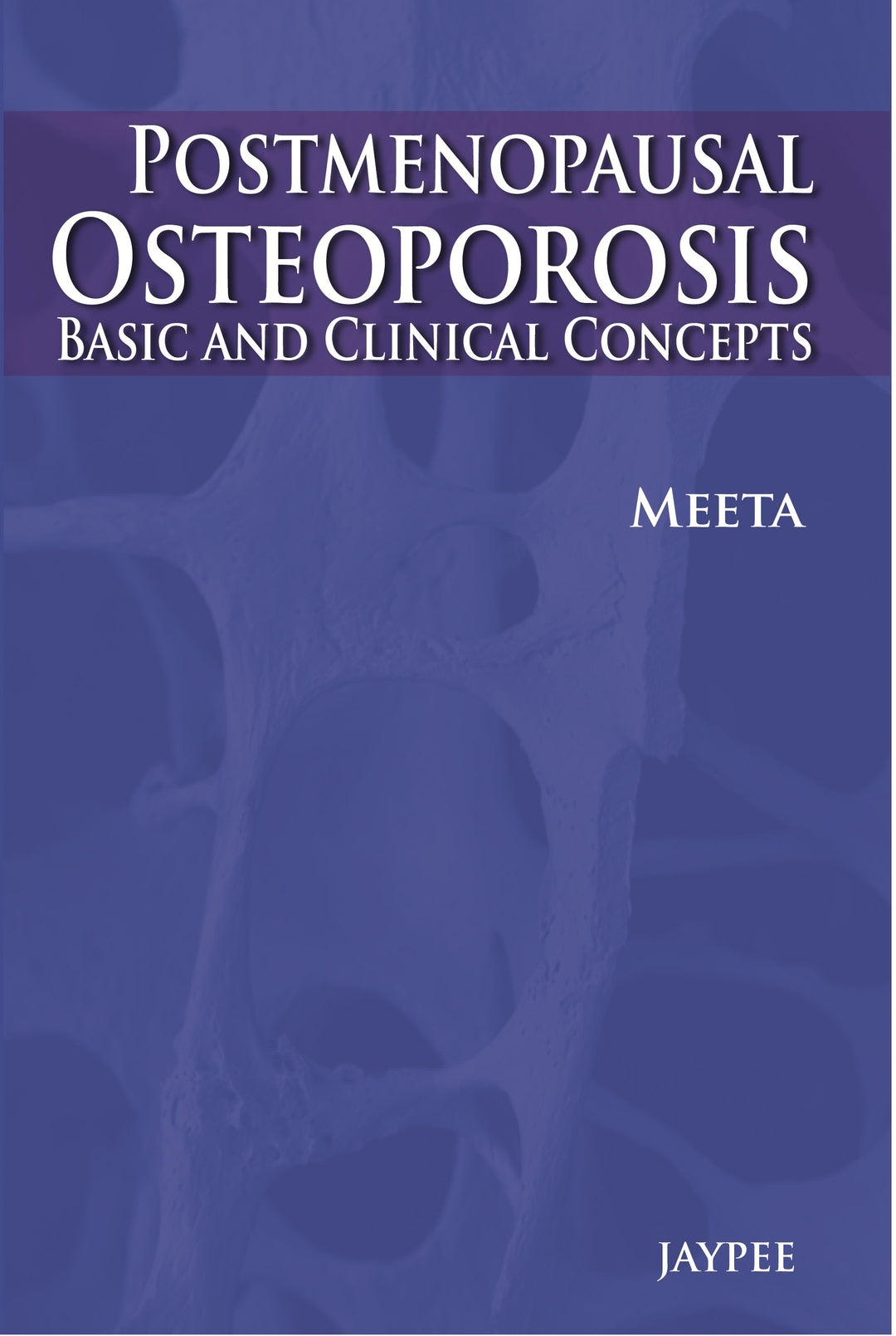 Cover image for Post-Menopausal Osteoporosis ISBN 9789350900857