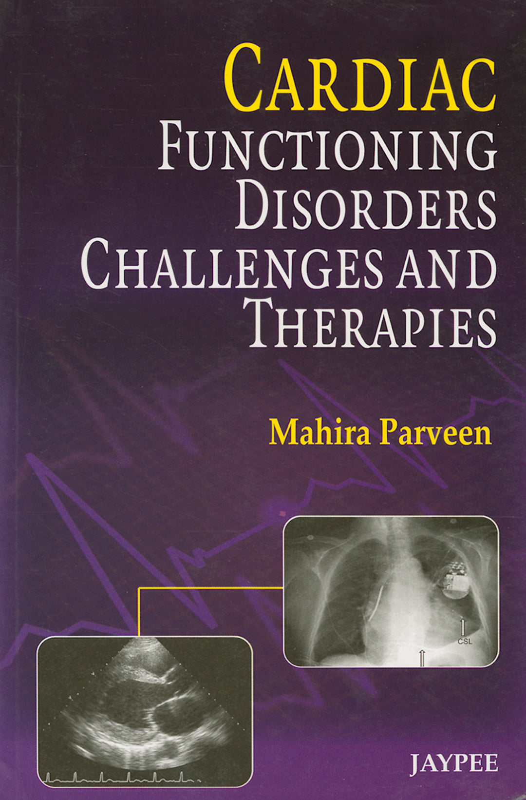 Cover image for Cardiac Functioning, Disorders, Challenges and Therapies ISBN 9789350903063