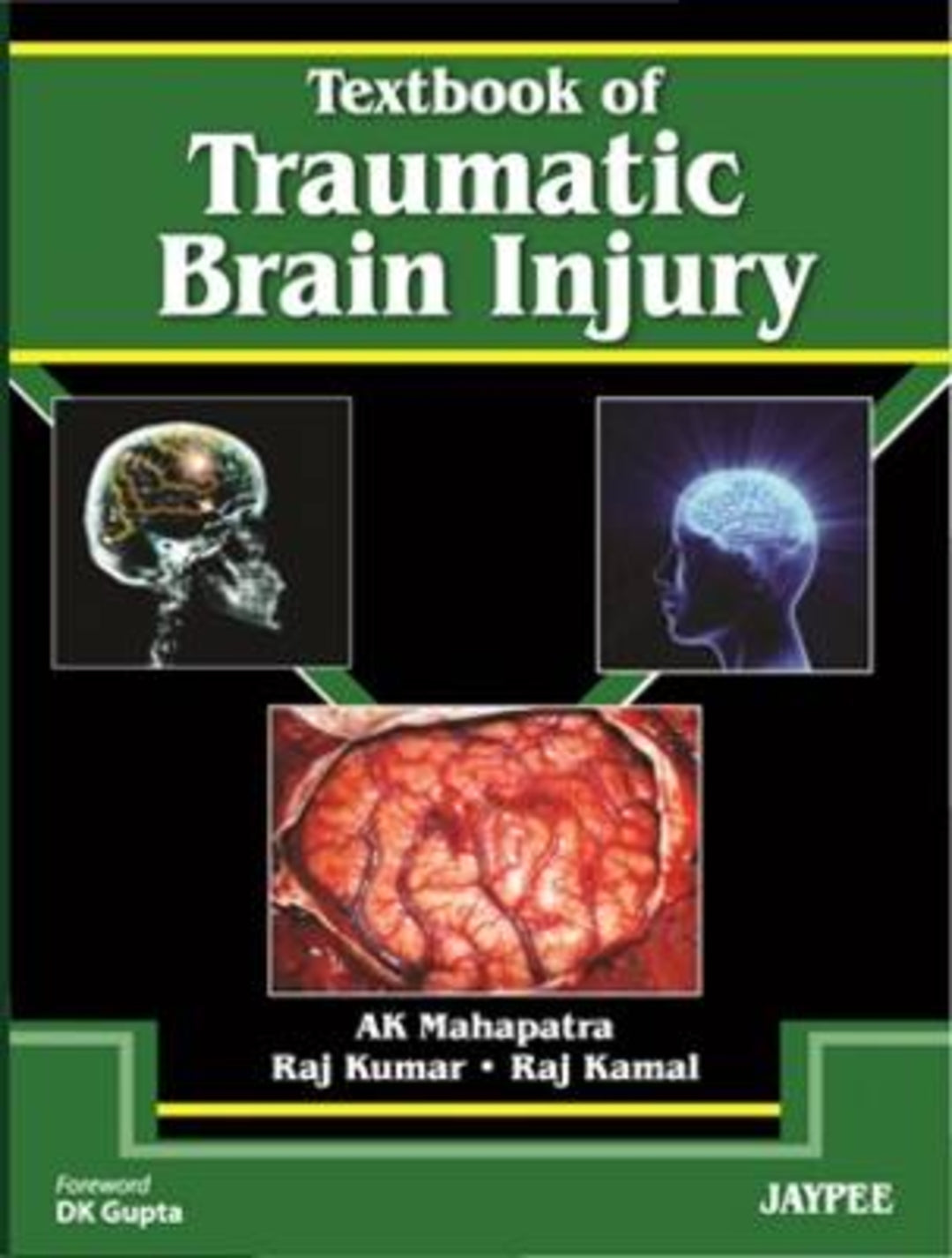 Cover image for Textbook of Traumatic Brain Injury ISBN 9789380704760