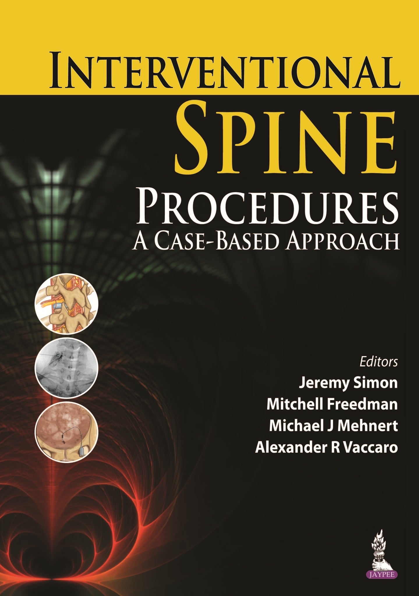 Interventional Spine Procedures