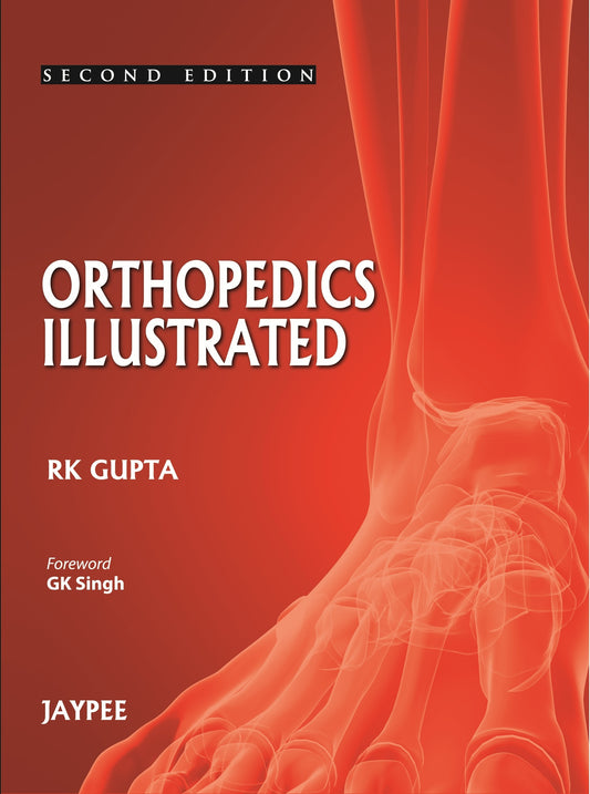 Orthopedics Illustrated