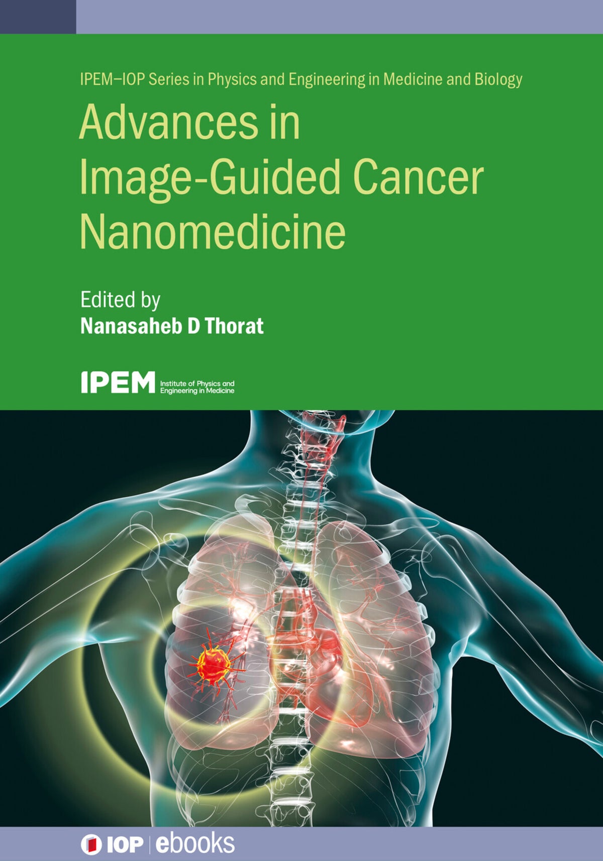 Cover image for Advances in Image-Guided Cancer Nanomedicine ISBN 9780750336734