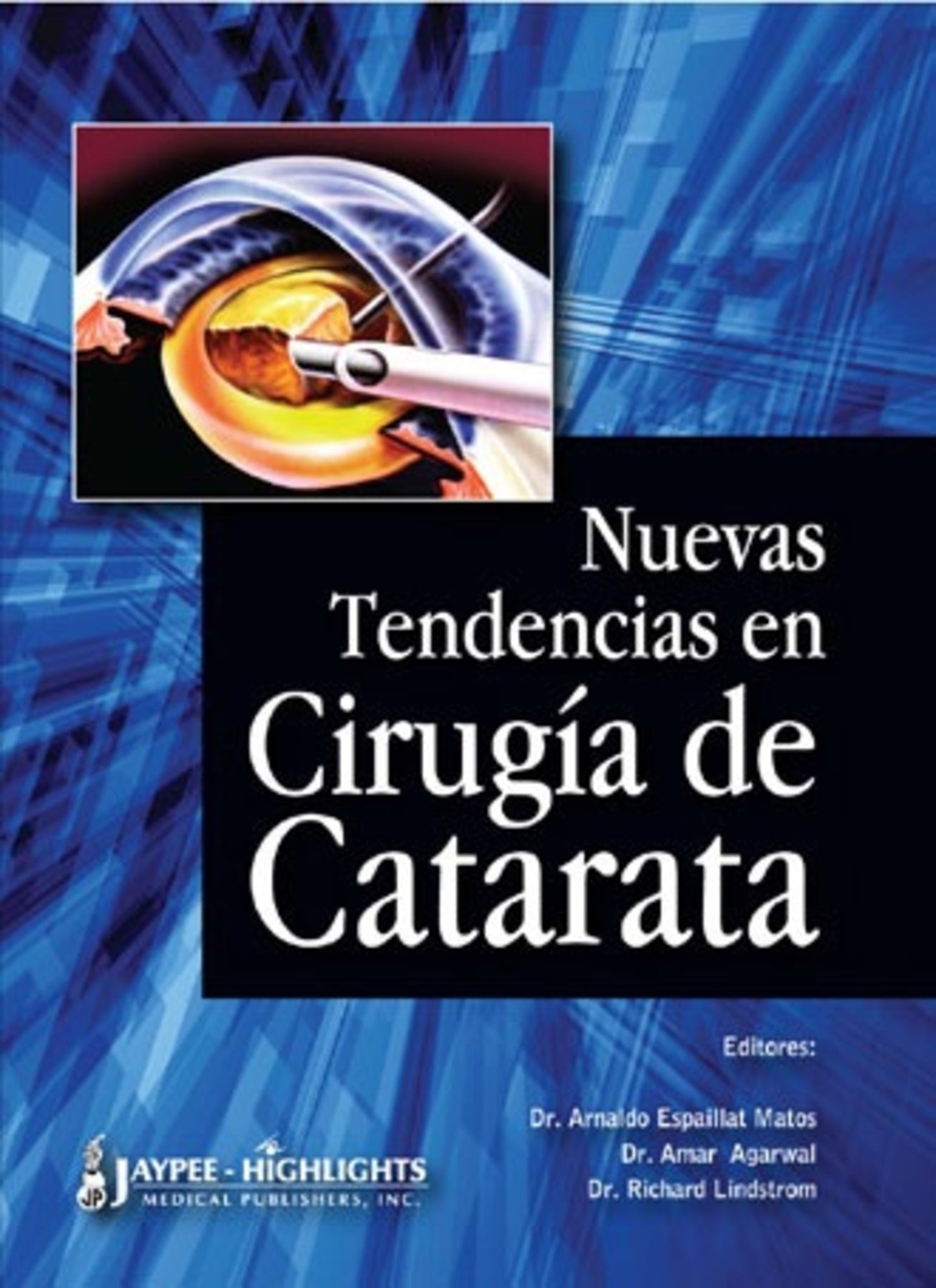 Nuevas Tendencias en Cirugía de Catarata