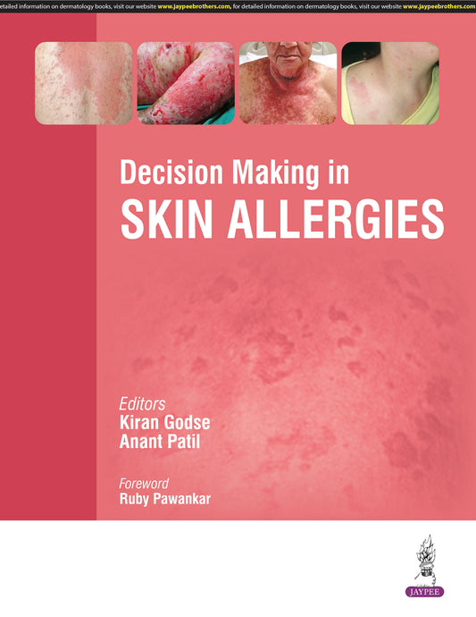 Decision Making in Skin Allergies