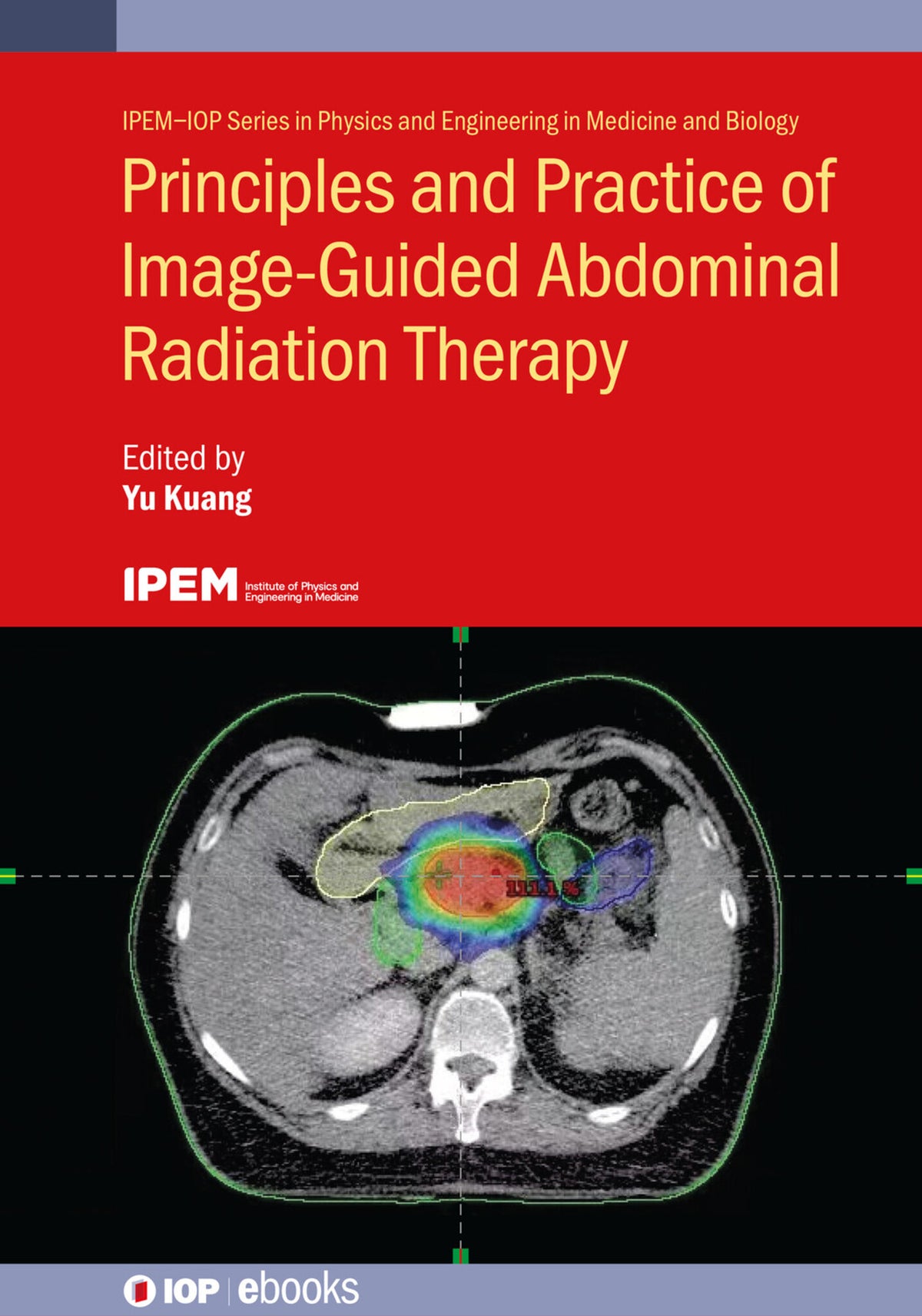 Cover image for Principles and Practice of Image-Guided Abdominal Radiation Therapy ISBN 9780750324694