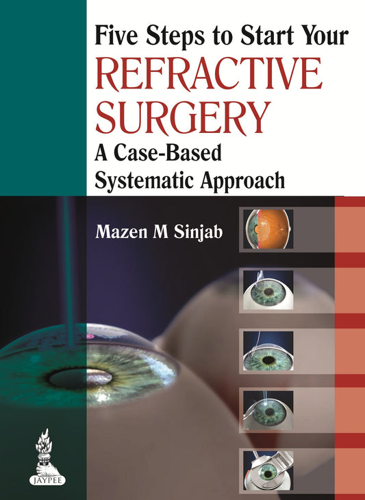 Five Steps to Start Your Refractive Surgery