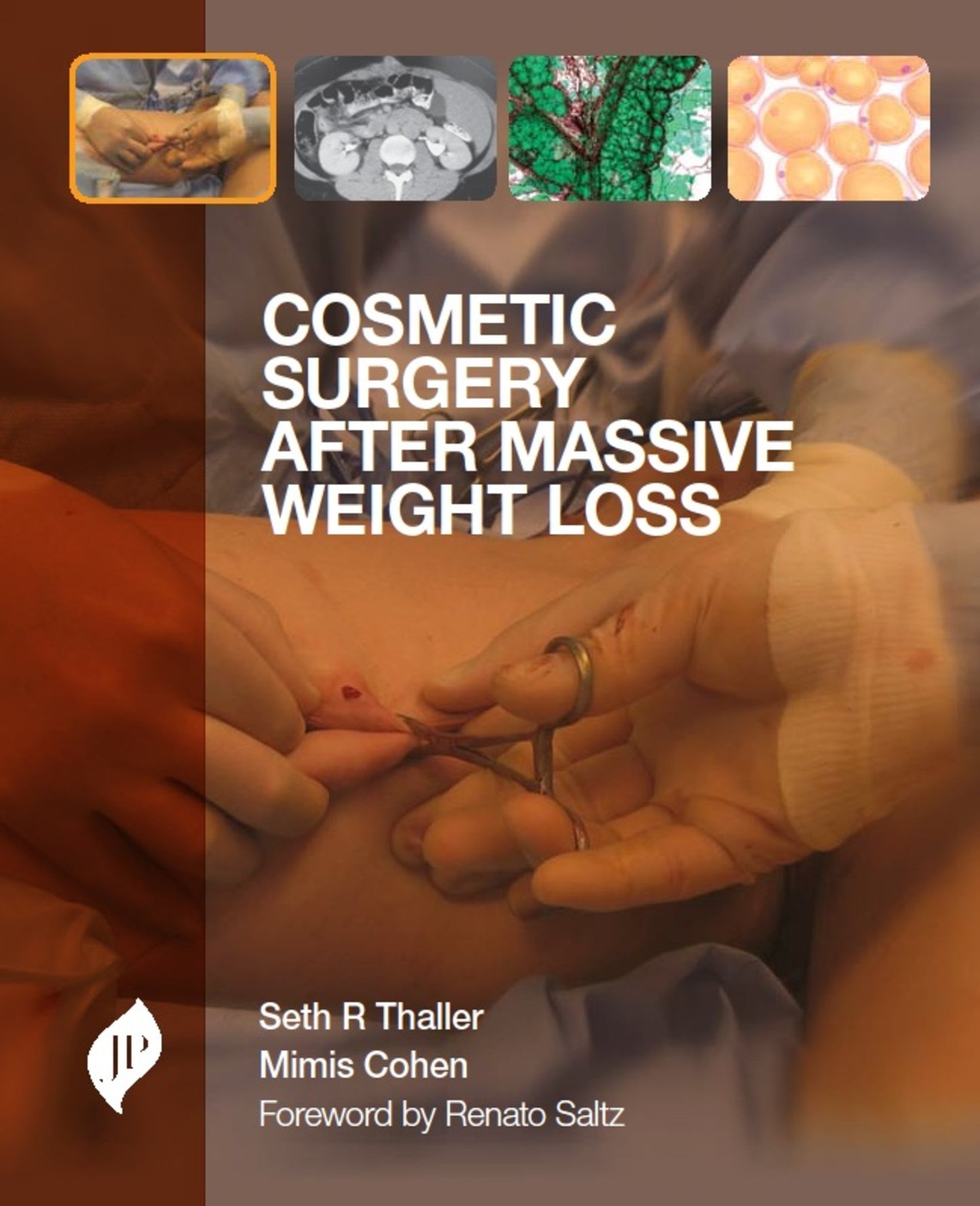 Cosmetic Surgery after Massive Weight Loss