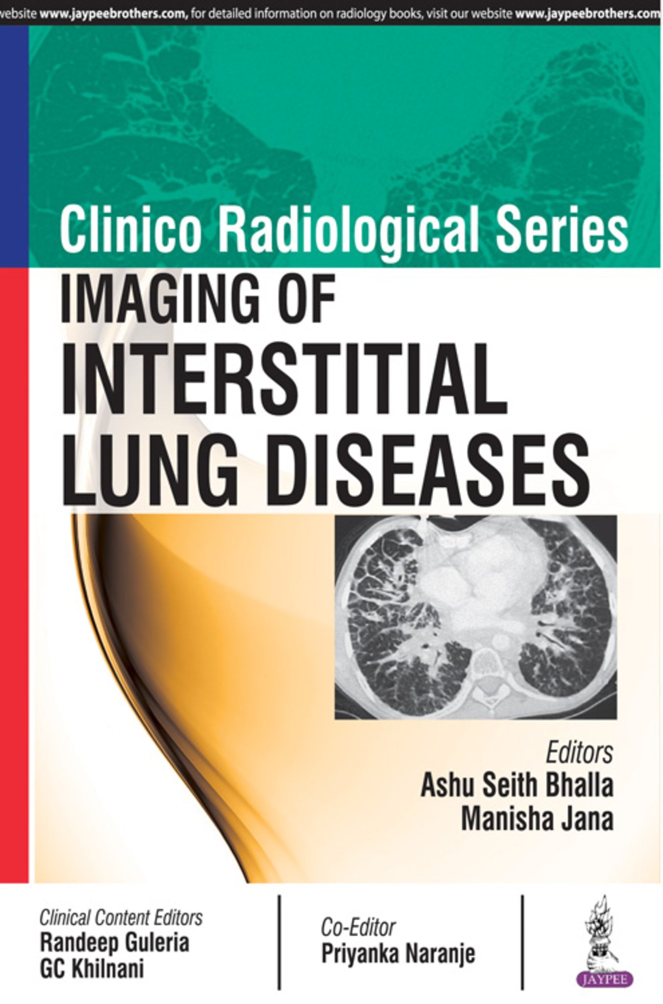 Clinico Radiological Series: Imaging of Interstitial Lung Diseases