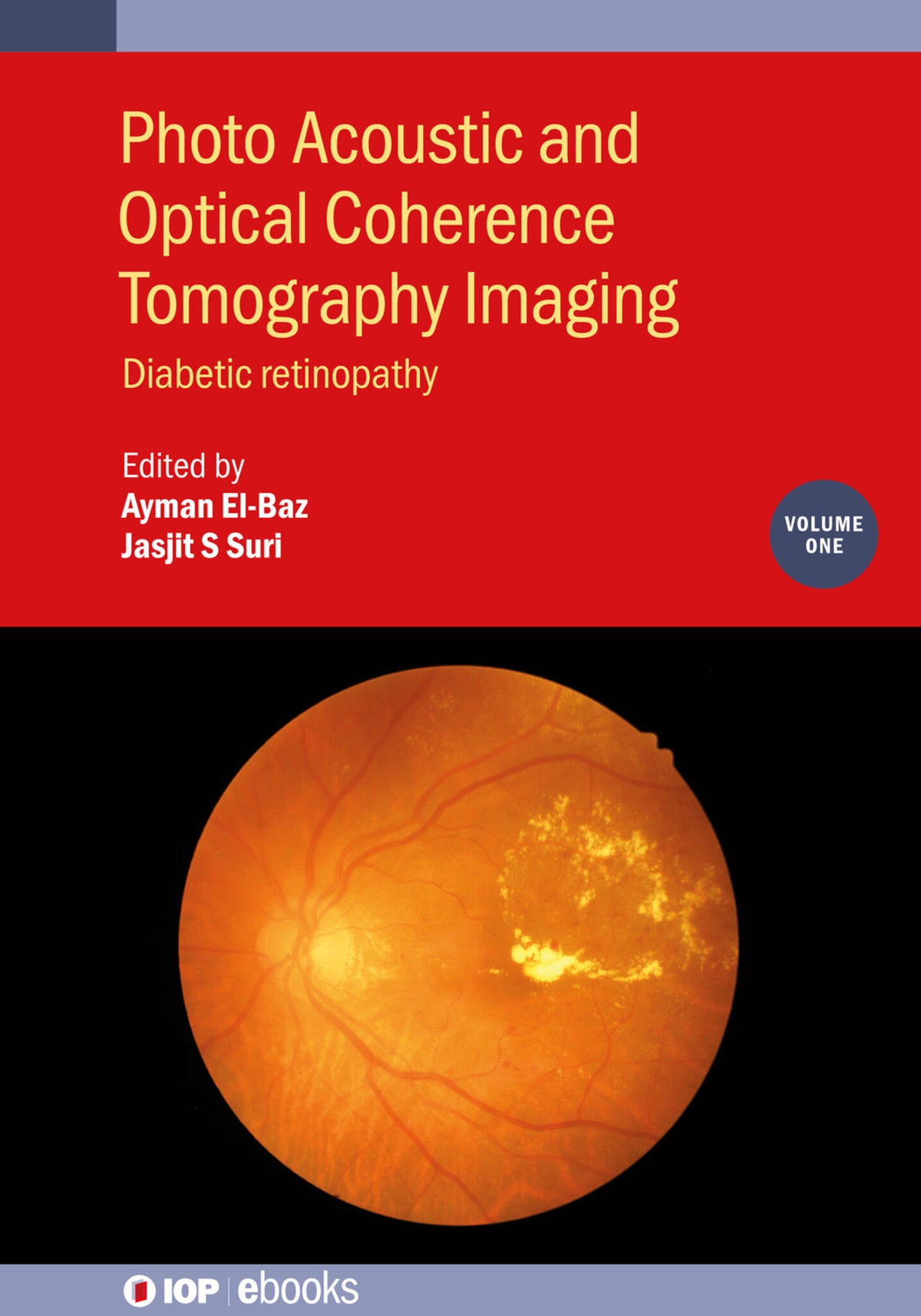 Cover image for Photo Acoustic and Optical Coherence Tomography Imaging, Volume 1 ISBN 9780750320528