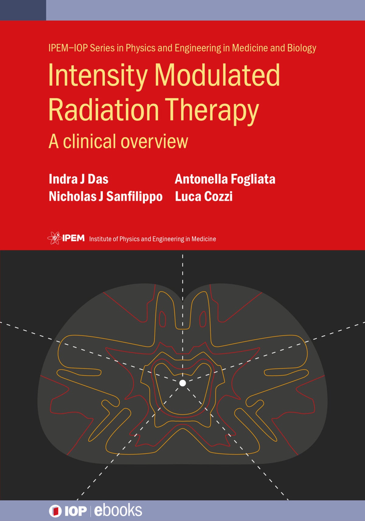 Cover image for Intensity Modulated Radiation Therapy ISBN 9780750317696