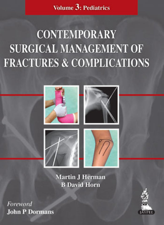Contemporary Surgical Management of Fractures and Complications
