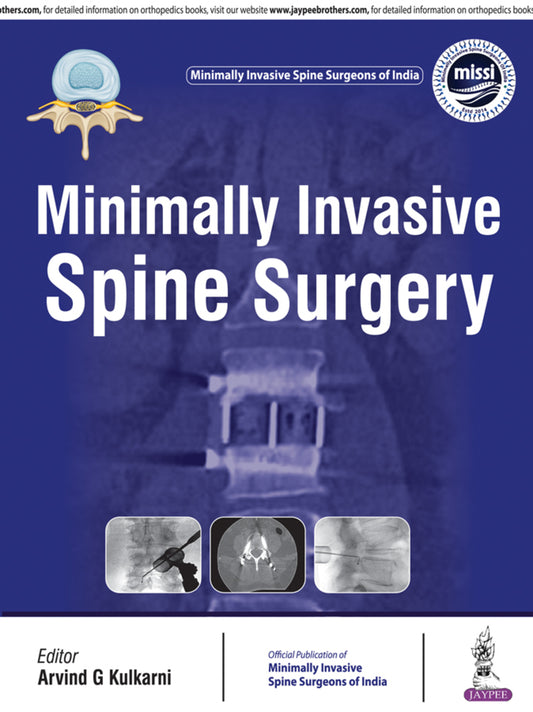 Minimally Invasive Spine Surgery