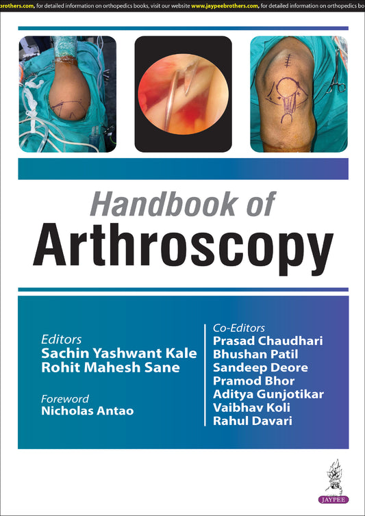Handbook of Arthroscopy
