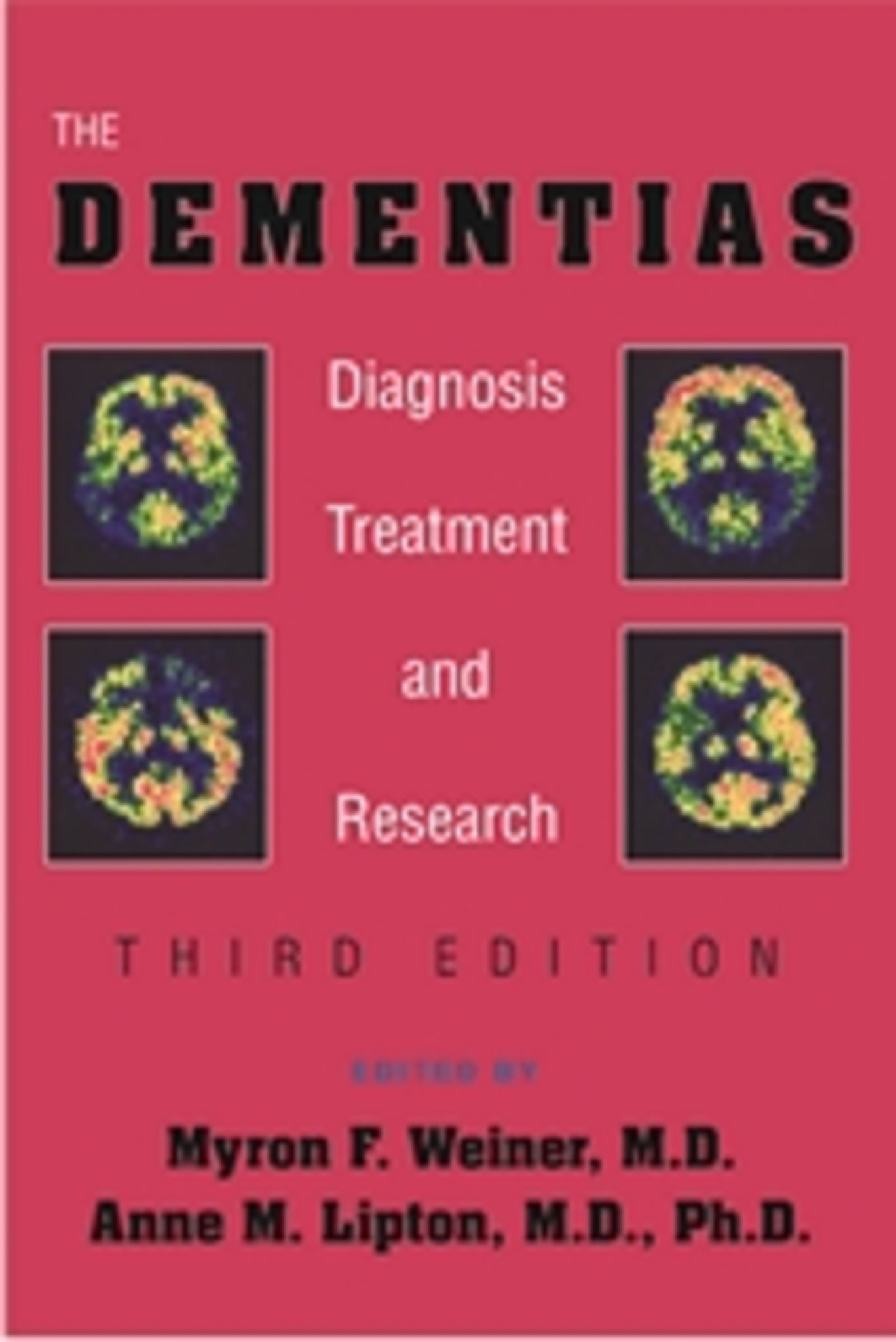 The Dementias