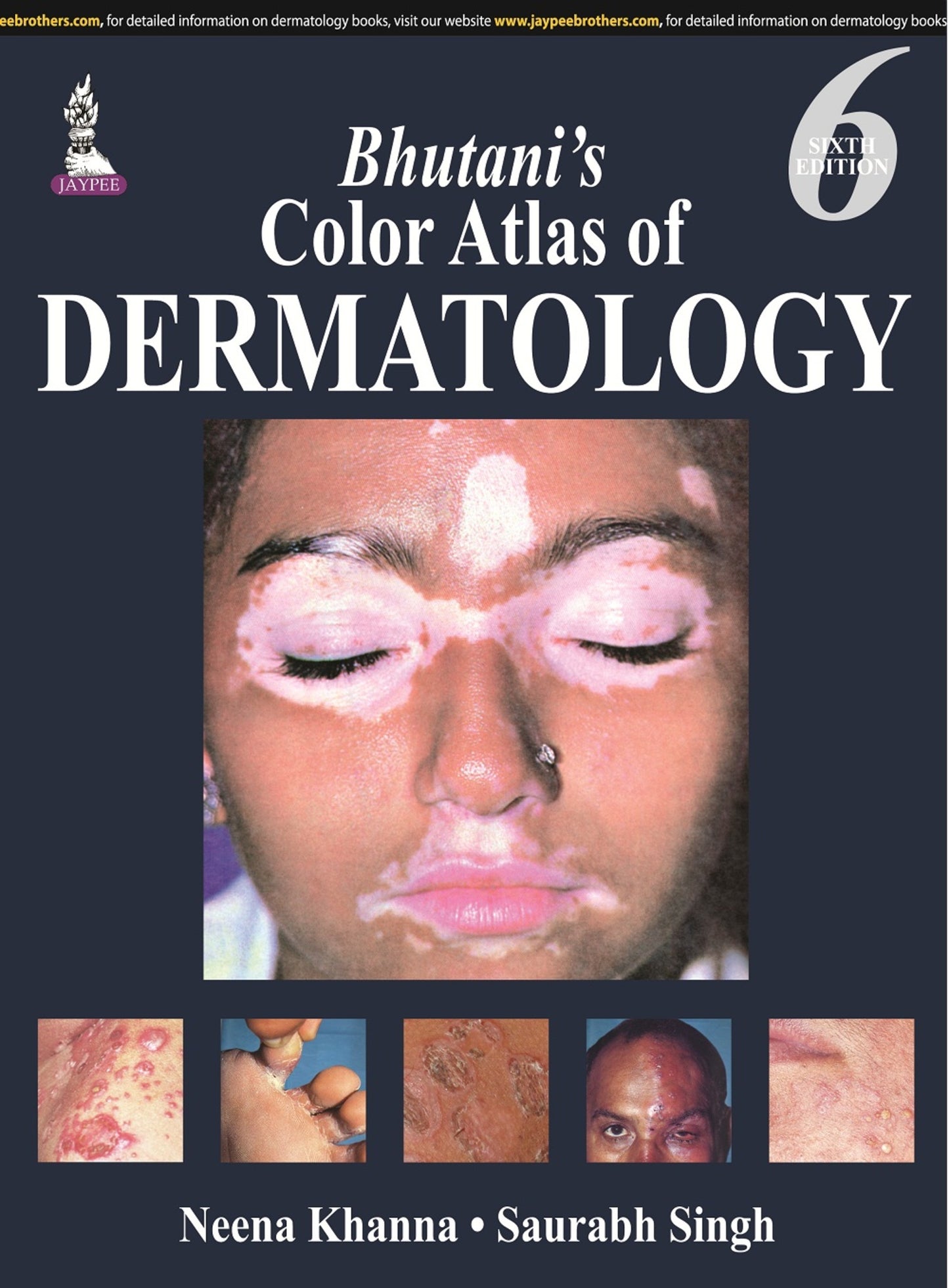Bhutani’s Color Atlas of Dermatology