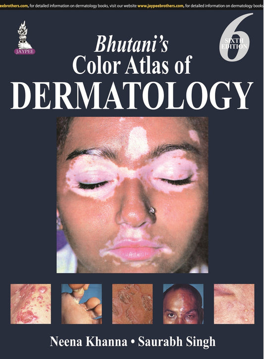Bhutani’s Color Atlas of Dermatology