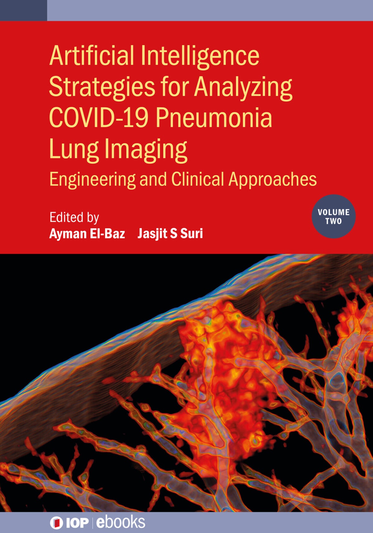Cover image for Artificial Intelligence Strategies for Analyzing COVID-19 Pneumonia Lung Imaging, Volume 2 ISBN 9780750338004