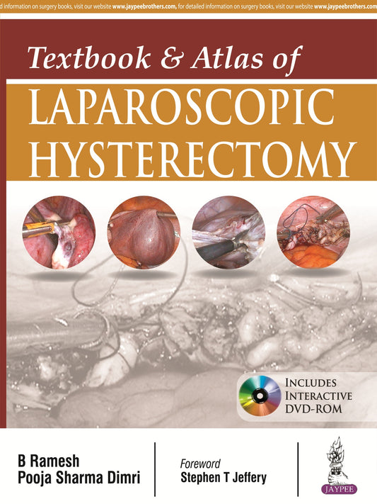 Textbook & Atlas of Laparoscopic Hysterectomy