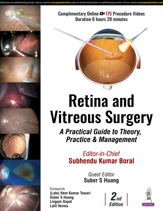 Retina and Vitreous Surgery