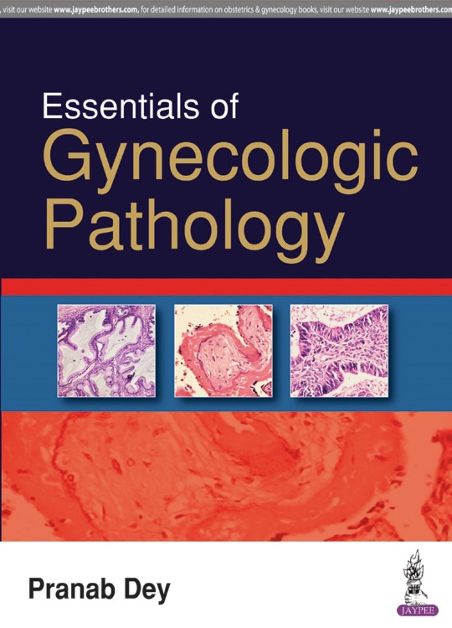 Essentials of Gynecologic Pathology
