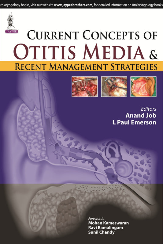 Current Concepts of Otitis Media and Recent Management Strategies