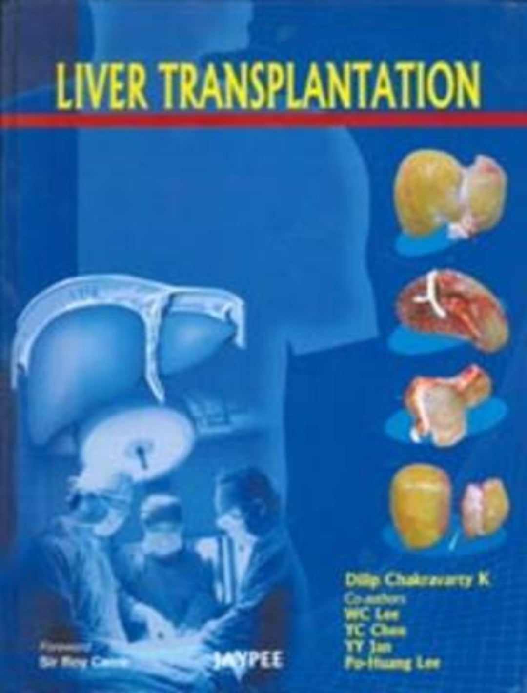 Cover image for Liver Transplantation ISBN 9788184487701