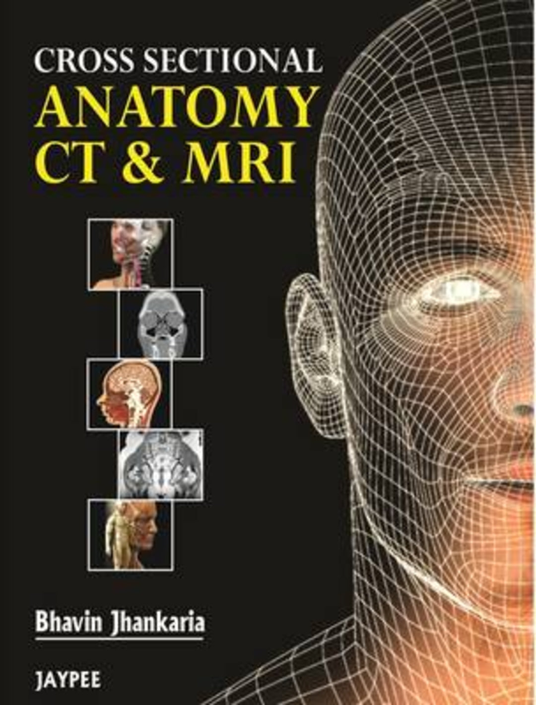 Cover image for Cross Sectional Anatomy CT and MRI ISBN 9789350250464