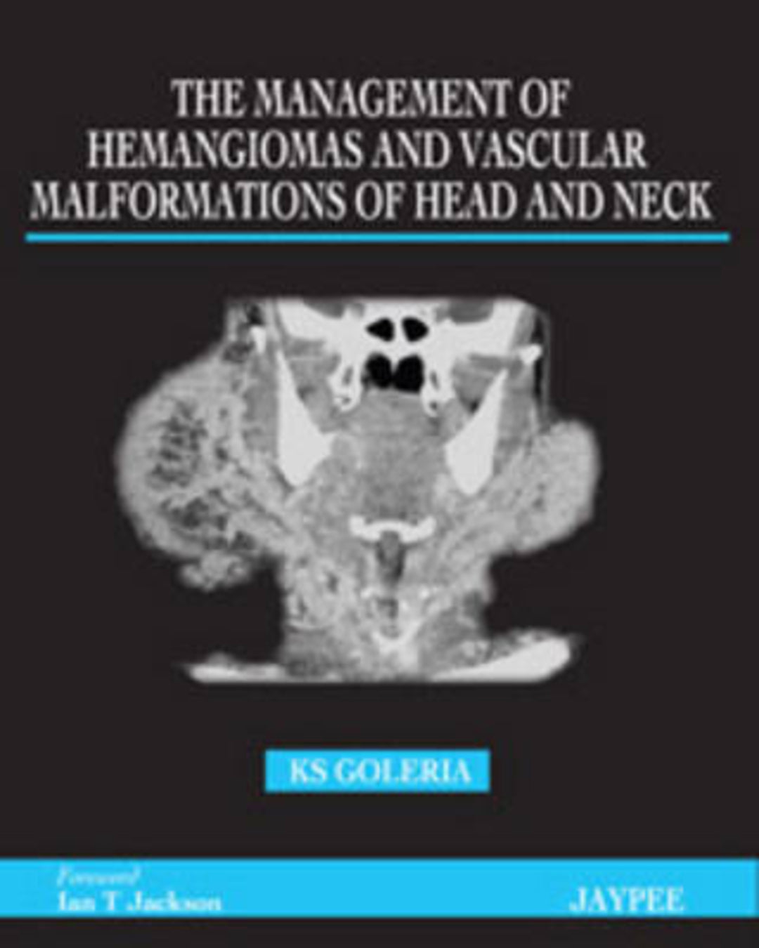 Cover image for The Management of Haemangiomas and Vascular Malformations of Head and Neck ISBN 9789350251256