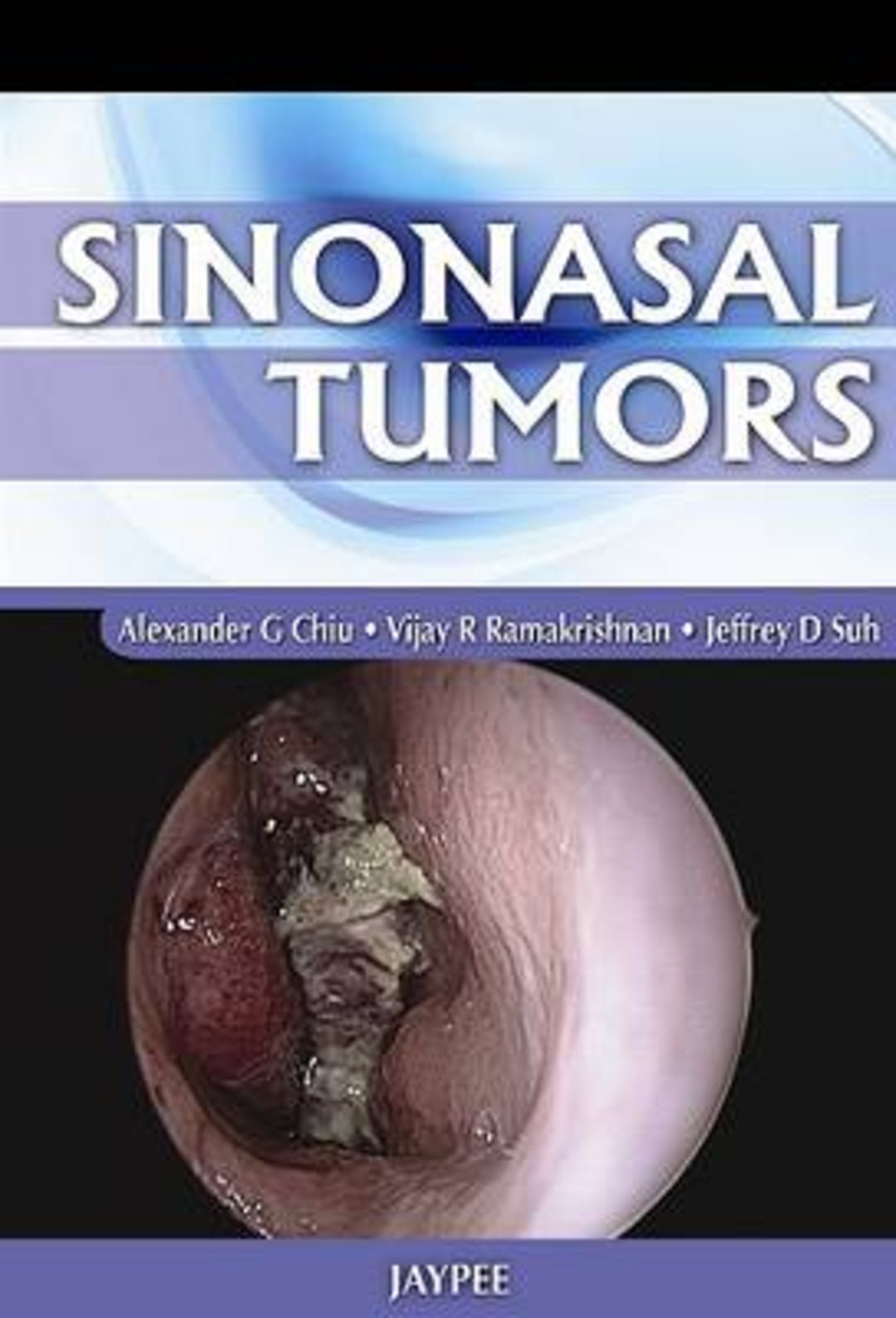 Cover image for Sinonasal Tumors ISBN 9789350252826