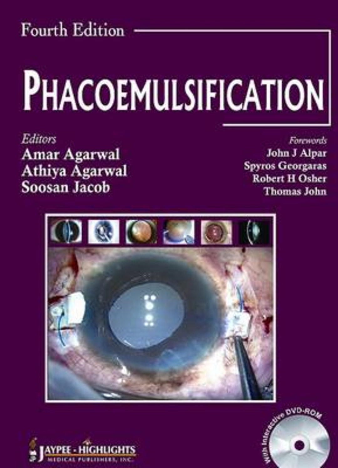 Cover image for Phacoemulsification, Fourth Edition ISBN 9789350254837