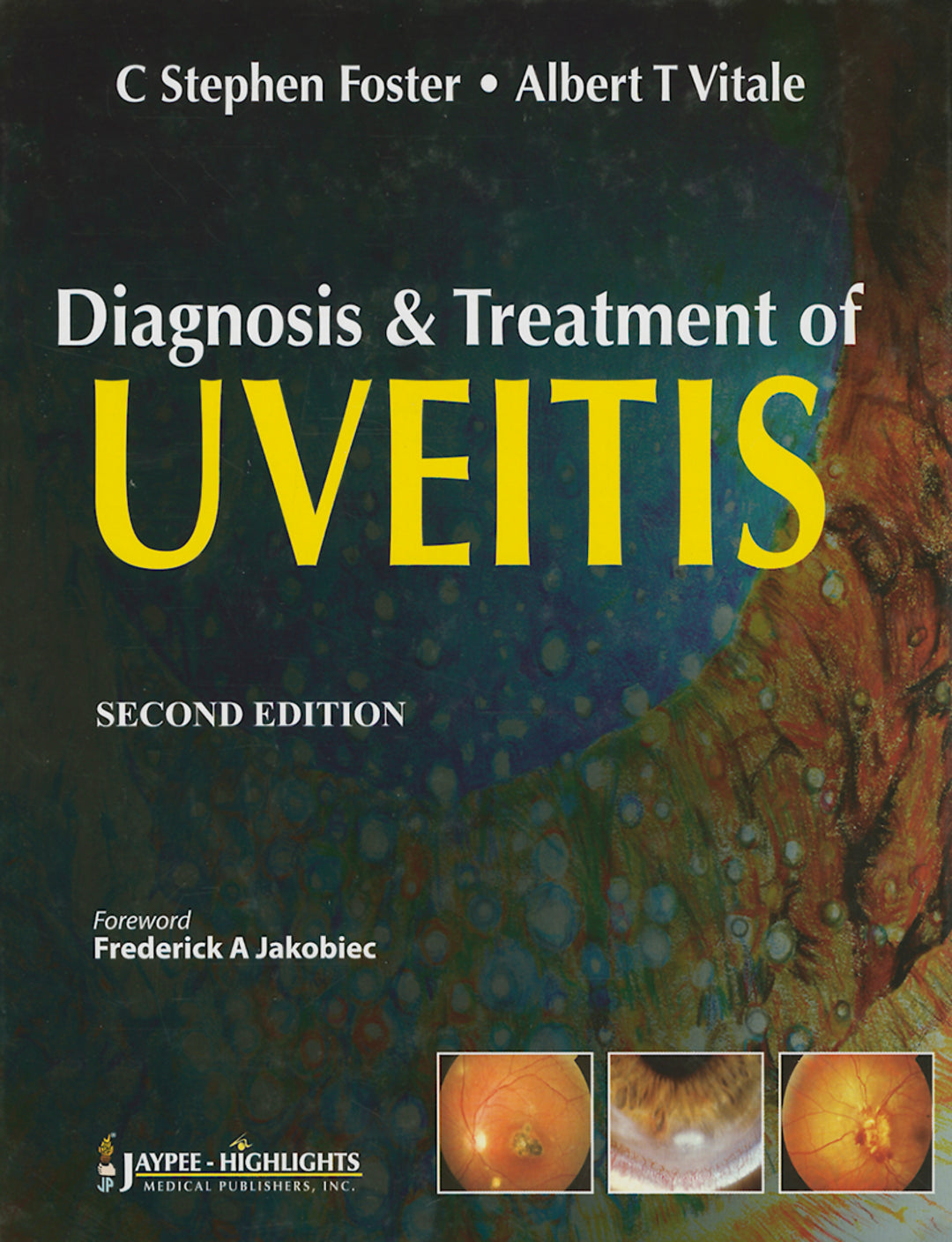 Cover image for Diagnosis & Treatment of Uveitis ISBN 9789350255728