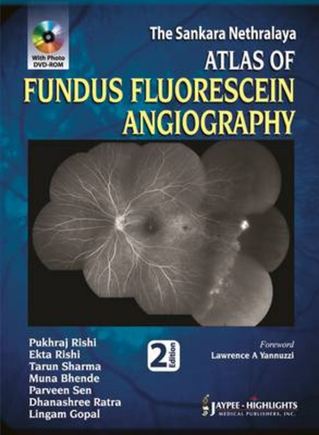 Cover image for Atlas of Fundus Fluorescein Angiography ISBN 9789350255773