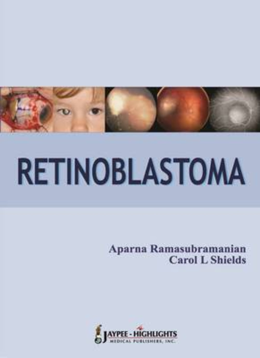 Cover image for Retinoblastoma ISBN 9789350257845