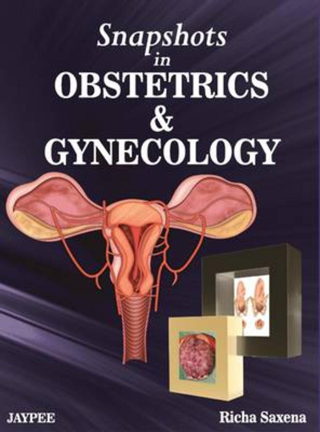 Cover image for Snapshots in Obstetrics and Gynaecology ISBN 9789350258026