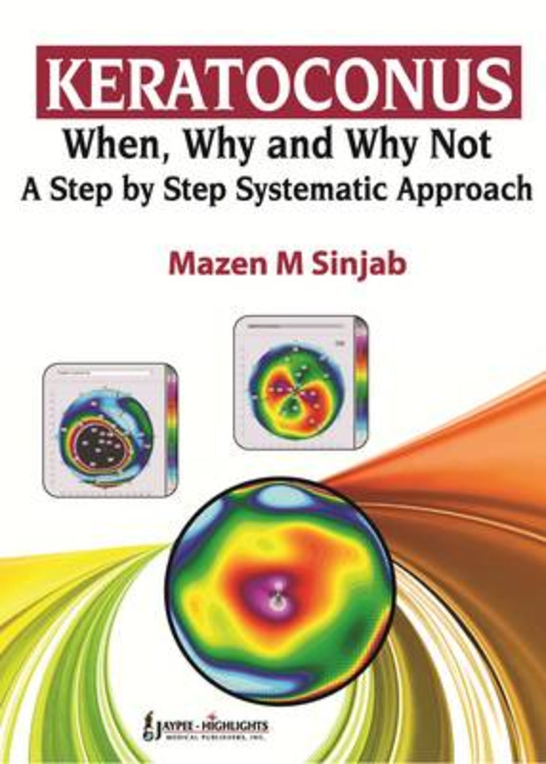 Cover image for Keratoconus: When, Why and Why Not: A Step by Step Systematic Approach ISBN 9789350259221