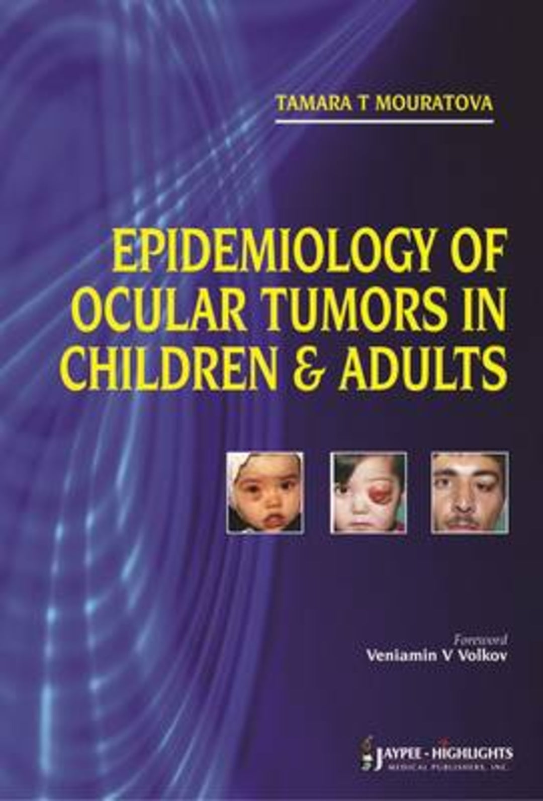 Cover image for Epidemiology of Ocular Tumors in Children & Adults ISBN 9789350259481