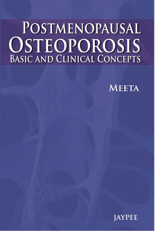 Post-Menopausal Osteoporosis