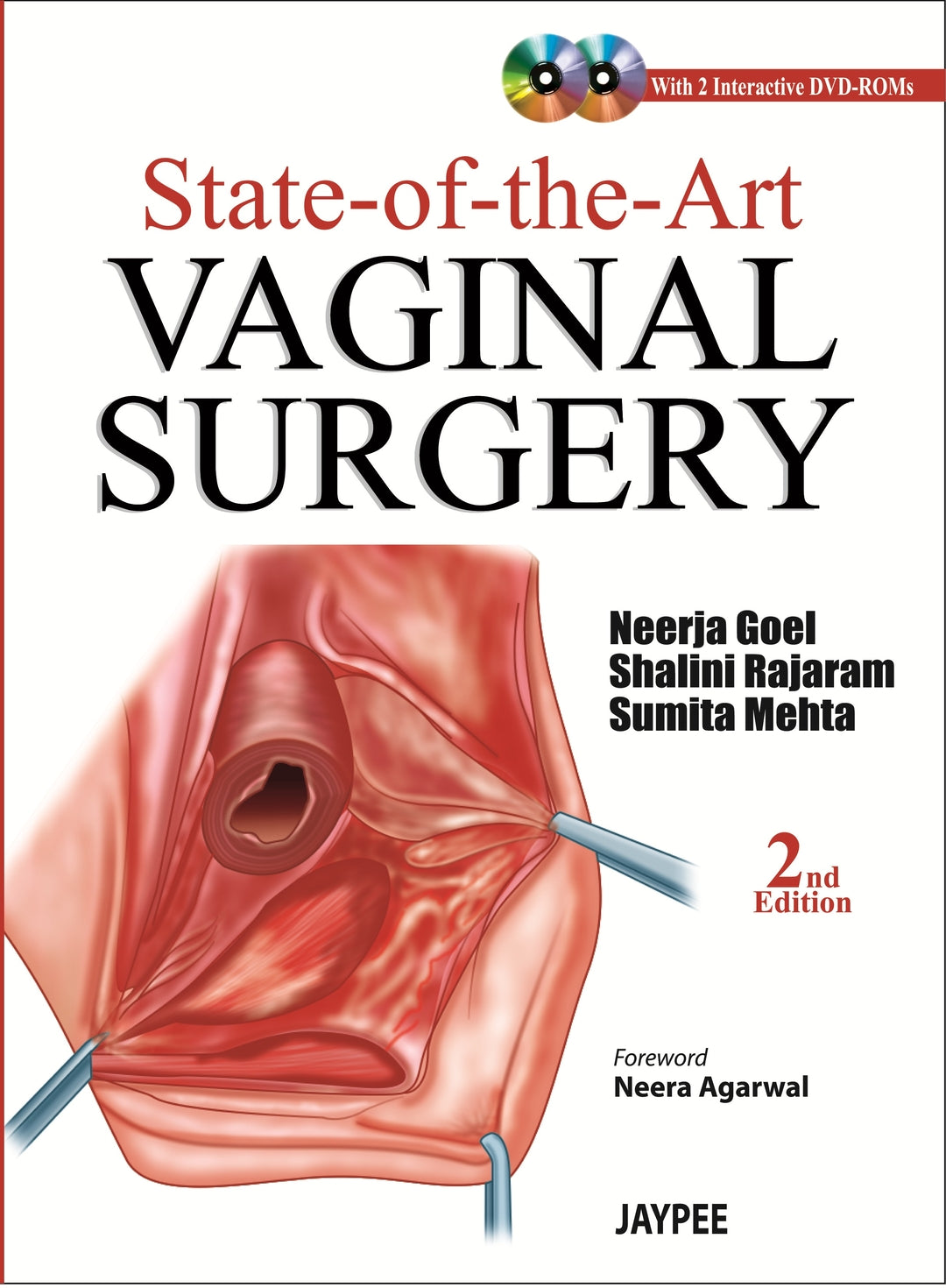 Cover image for State-of-the-Art Vaginal Surgery ISBN 9789350902875