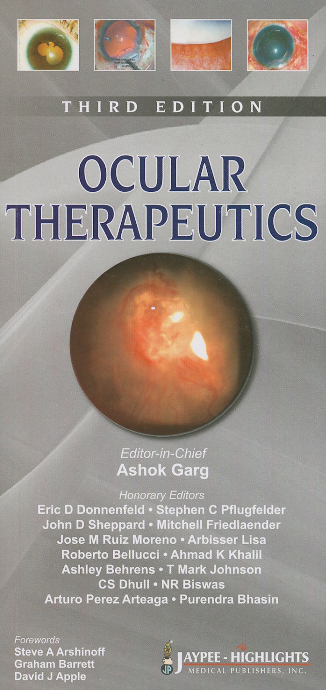 Cover image for Ocular Therapeutics ISBN 9789350903209