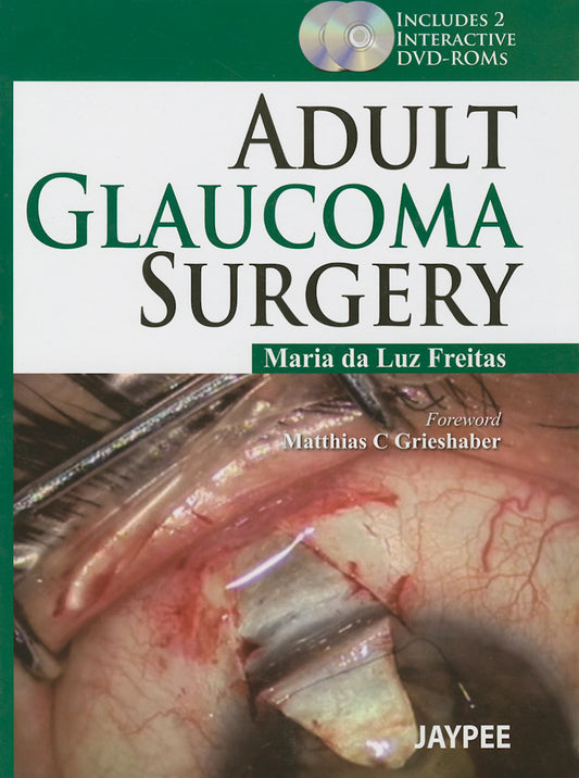 Adult Glaucoma Surgery