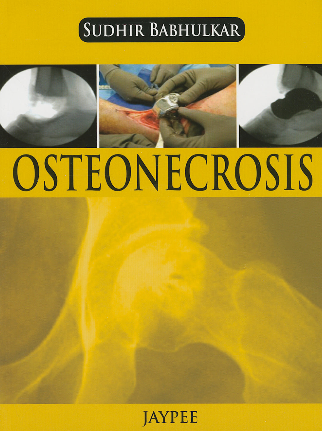 Cover image for Osteonecrosis ISBN 9789350904077