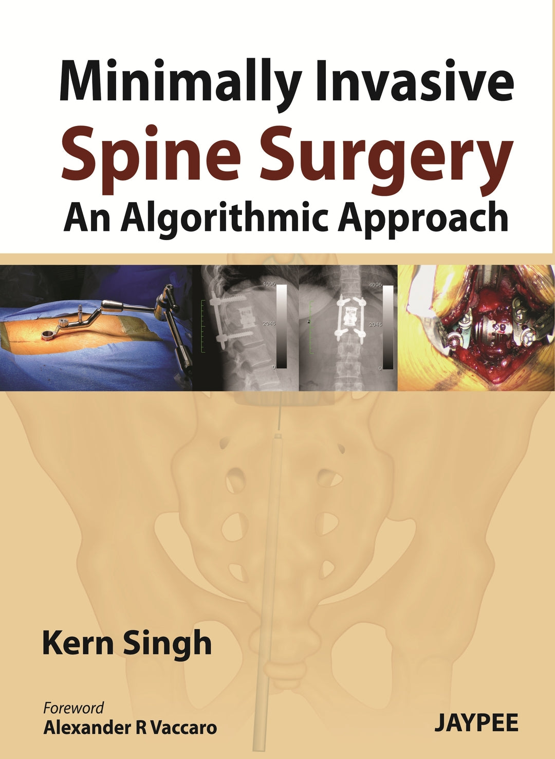 Cover image for Minimally Invasive Spine Surgery: An Algorithmic Approach ISBN 9789350904848